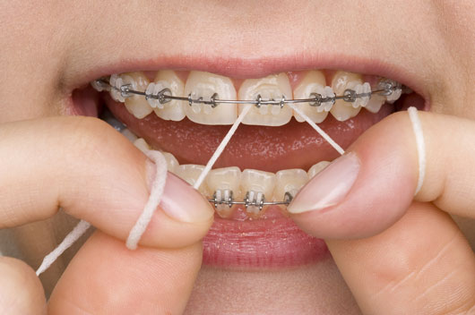 The-Lost-Art-of-Flossing-15-Reasons-to-Never-Skip-this-Step-photo12